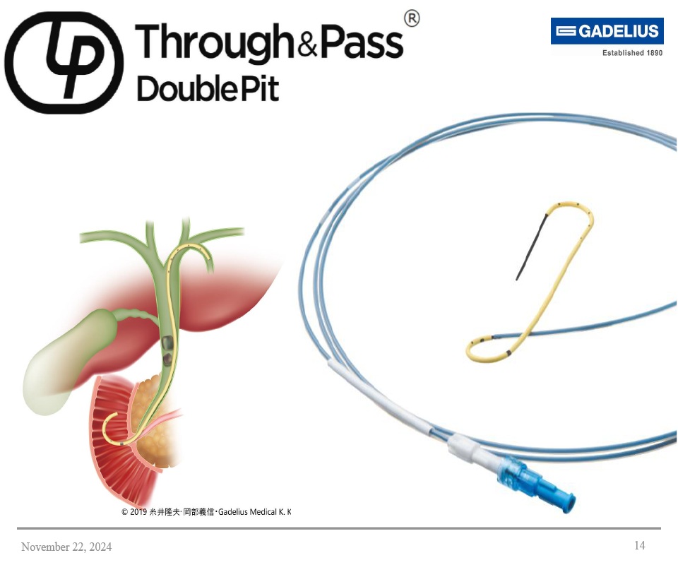 DoublePit